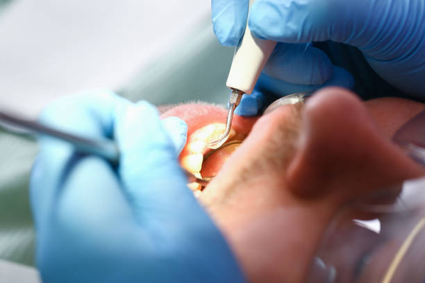 Best Broken Tooth Emergency  in Glendale, MO